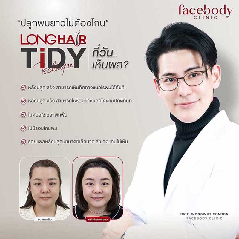 Facebody_Long-Hair-นายแพทย์ธีร์.jpg