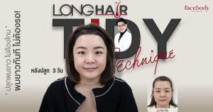 ปลูกผมไม่ต้องโกน ผมยาว